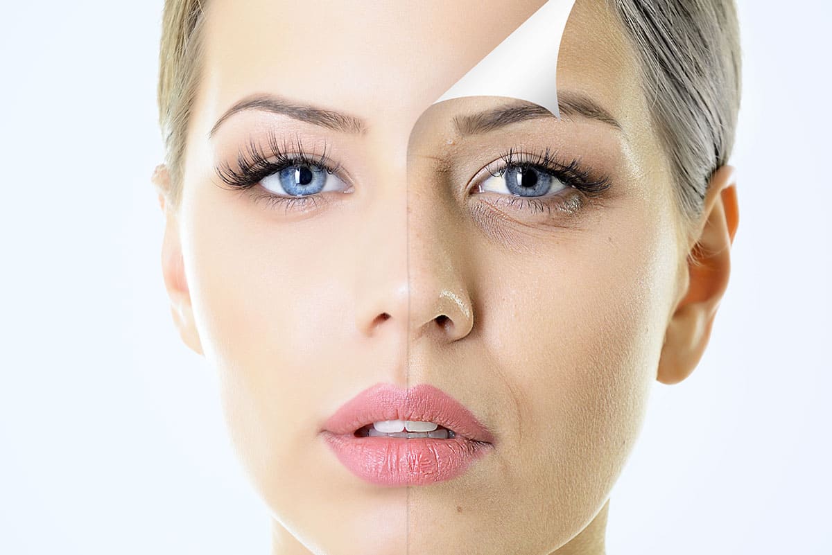 Peeling de Fenol: Cuidados e Informações Essenciais