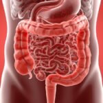 Imagem em 3D do sistema digestivo com foco no intestino inflamado, estilo moderno, educativo e profissional para blog de saúde."
