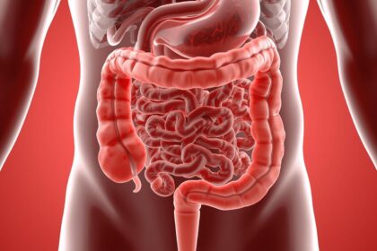 Imagem em 3D do sistema digestivo com foco no intestino inflamado, estilo moderno, educativo e profissional para blog de saúde."