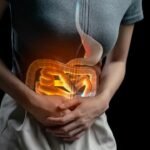 Mulher com dor abdominal causada por infecção intestinal.