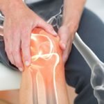 Melhores Ervas Naturais para Tratar Dores no Joelho com Receita